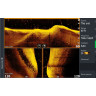 Трансдьюсер LOWRANCE Active Imaging 3-in-1 000-14489-001